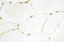 SMAD1+5+9 Antibody - IHC of Smad1/5/9 (Q22) pAb in paraffin-embedded human skeletal muscle tissue.