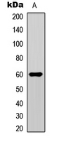SMAD1+9 Antibody - Western blot analysis of SMAD1/9 (pS465/467) expression in HeLa (A) whole cell lysates.