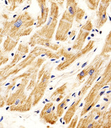 SMAD1 Antibody - Immunohistochemical of paraffin-embedded H. heart section using SMAD1 Antibody. Antibody was diluted at 1:25 dilution. A peroxidase-conjugated goat anti-rabbit IgG at 1:400 dilution was used as the secondary antibody, followed by DAB staining.