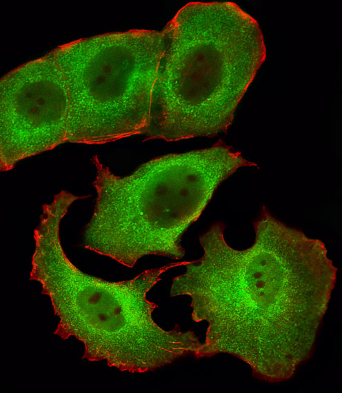 SMAD1 Antibody - Fluorescent image of MCF-7 cells stained with SMAD1 Antibody. Antibody was diluted at 1:25 dilution. An Alexa Fluor 488-conjugated goat anti-rabbit lgG at 1:400 dilution was used as the secondary antibody (green). Cytoplasmic actin was counterstained with Alexa Fluor 555 conjugated with Phalloidin (red).