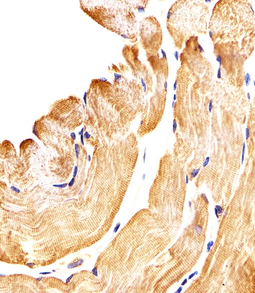 SMAD1 Antibody - Immunohistochemical of paraffin-embedded H. skeletal muscle section using SMAD1 Antibody. Antibody was diluted at 1:25 dilution. A peroxidase-conjugated goat anti-rabbit IgG at 1:400 dilution was used as the secondary antibody, followed by DAB staining.