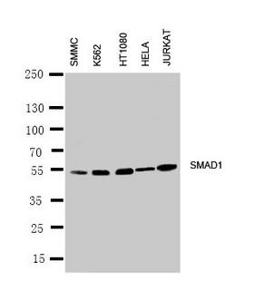 SMAD1 Antibody - WB of SMAD1 antibody. Lane 1: SMMC Cell Lysate. Lane 2: K562 Cell Lysate. Lane 3: HT1080 Cell Lysate. Lane 4: HELA Cell Lysate. Lane 5: JURKAT Cell Lysate.