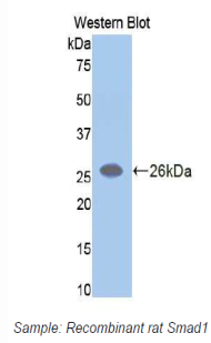 SMAD1 Antibody - Western blot of recombinant SMAD1.  This image was taken for the unconjugated form of this product. Other forms have not been tested.