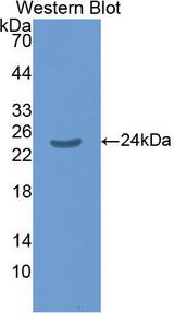 SMAD1 Antibody - Western Blot; Sample: Recombinant protein.