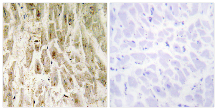 SMAD1 Antibody - Immunohistochemistry analysis of paraffin-embedded human heart tissue, using Smad1 Antibody. The picture on the right is blocked with the synthesized peptide.