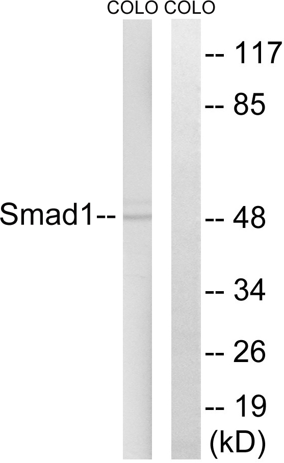 SMAD1 Antibody - Western blot analysis of lysates from COLO cells, treated with EGF 200ng/ml 30', using Smad1 Antibody. The lane on the right is blocked with the synthesized peptide.