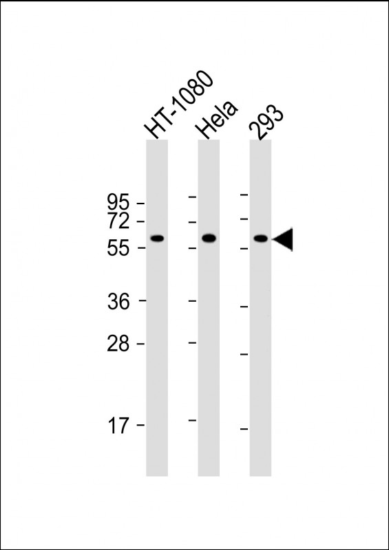 SMAD1 Antibody - All lanes: Anti-SMAD1 Antibody at 1:2000 dilution Lane 1: HT-1080 whole cell lysate Lane 2: Hela whole cell lysate Lane 3: 293 whole cell lysate Lysates/proteins at 20 µg per lane. Secondary Goat Anti-mouse IgG, (H+L), Peroxidase conjugated at 1/10000 dilution. Predicted band size: 60 kDa Blocking/Dilution buffer: 5% NFDM/TBST.