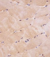 SMAD1 Antibody - SMAD1 Antibody staining SMAD1 in human skeletal muscle tissue sections by Immunohistochemistry (IHC-P - paraformaldehyde-fixed, paraffin-embedded sections). Tissue was fixed with formaldehyde and blocked with 3% BSA for 0. 5 hour at room temperature; antigen retrieval was by heat mediation with a citrate buffer (pH6). Samples were incubated with primary antibody (1/25) for 1 hours at 37°C. A undiluted biotinylated goat polyvalent antibody was used as the secondary antibody.