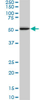 SMAD1 Antibody - SMAD1 monoclonal antibody (M02), clone 1D3. Western blot of SMAD1 expression in A-549.