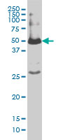 SMAD1 Antibody - SMAD1 monoclonal antibody (M02), clone 1D3 Western blot of SMAD1 expression in IMR-32.