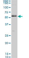 SMAD1 Antibody - SMAD1 monoclonal antibody (M02), clone 1D3. Western blot of SMAD1 expression in MES-SA/Dx5.