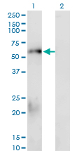 SMAD1 Antibody - Western blot of SMAD1 expression in transfected 293T cell line by SMAD1 monoclonal antibody (M02), clone 1D3.