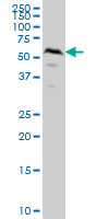 SMAD1 Antibody - SMAD1 monoclonal antibody (M04), clone 2A1 Western blot of SMAD1 expression in HeLa.