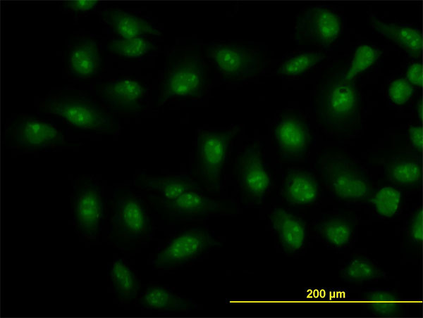 SMAD1 Antibody - Immunofluorescence of monoclonal antibody to SMAD1 on HeLa cell. [antibody concentration 10 ug/ml]
