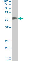 SMAD1 Antibody - SMAD1 monoclonal antibody (M03), clone 2E9. Western blot of SMAD1 expression in IMR-32.