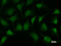 SMAD1 Antibody - Immunostaining analysis in HeLa cells. HeLa cells were fixed with 4% paraformaldehyde and permeabilized with 0.1% Triton X-100 in PBS. The cells were immunostained with anti-SMAD1 mAb.