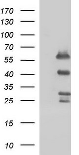 SMAD1 Antibody - HEK293T cells were transfected with the pCMV6-ENTRY control (Left lane) or pCMV6-ENTRY SMAD1 (Right lane) cDNA for 48 hrs and lysed. Equivalent amounts of cell lysates (5 ug per lane) were separated by SDS-PAGE and immunoblotted with anti-SMAD1.