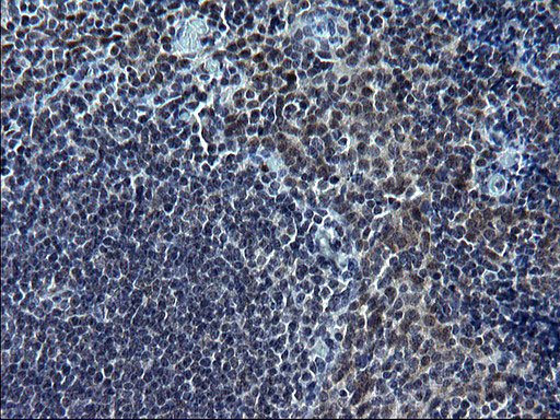 SMAD1 Antibody - IHC of paraffin-embedded Human lymph node tissue using anti-SMAD1 mouse monoclonal antibody. (Heat-induced epitope retrieval by 1 mM EDTA in 10mM Tris, pH8.5, 120°C for 3min).