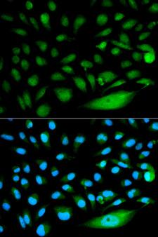 SMAD1 Antibody - Immunofluorescence analysis of HeLa cells.