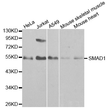 SMAD1 Antibody - Western blot analysis of extracts of various cell lines, using SMAD1 antibody at 1:1000 dilution. The secondary antibody used was an HRP Goat Anti-Rabbit IgG (H+L) at 1:10000 dilution. Lysates were loaded 25ug per lane and 3% nonfat dry milk in TBST was used for blocking.