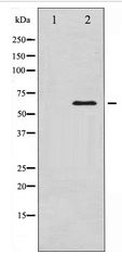 SMAD1 Antibody - Western blot of Smad1 expression in EGF treated COS7 whole cell lysates,The lane on the left is treated with the antigen-specific peptide.