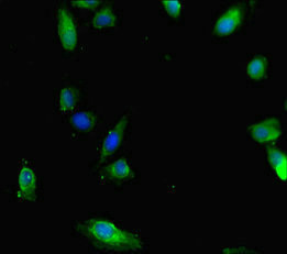 SMAD1 Antibody - Immunofluorescent analysis of Hela cells diluted at 1:100 and Alexa Fluor 488-congugated AffiniPure Goat Anti-Rabbit IgG(H+L)