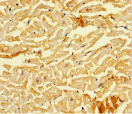 SMAD1 Antibody - Immunohistochemistry of paraffin-embedded human heart tissue at dilution 1:100