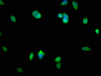 SMAD1 Antibody - Immunofluorescence staining of MCF-7 cells with SMAD1 Antibody at 1:400, counter-stained with DAPI. The cells were fixed in 4% formaldehyde, permeabilized using 0.2% Triton X-100 and blocked in 10% normal Goat Serum. The cells were then incubated with the antibody overnight at 4°C. The secondary antibody was Alexa Fluor 488-congugated AffiniPure Goat Anti-Rabbit IgG(H+L).