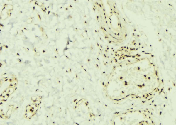 SMAD1 Antibody - 1:100 staining mouse muscle tissue by IHC-P. The sample was formaldehyde fixed and a heat mediated antigen retrieval step in citrate buffer was performed. The sample was then blocked and incubated with the antibody for 1.5 hours at 22°C. An HRP conjugated goat anti-rabbit antibody was used as the secondary.