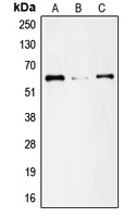 SMAD1 Antibody - Western blot analysis of SMAD1 expression in Jurkat (A); HeLa (B); Ramos (C) whole cell lysates.