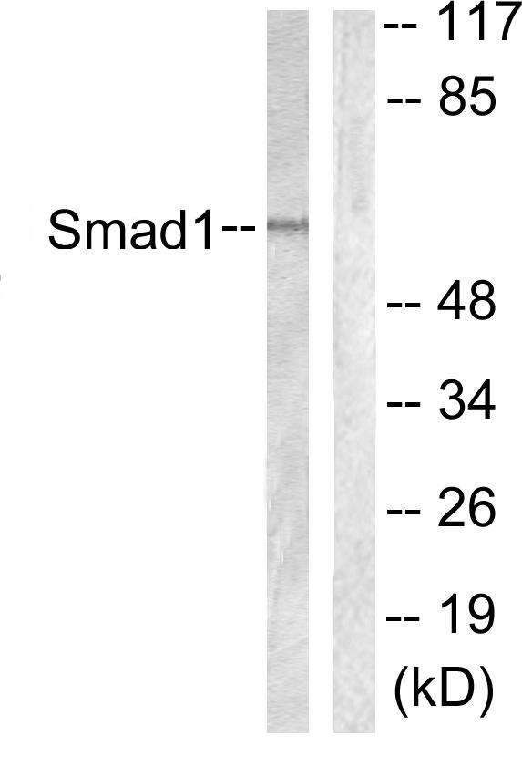 SMAD1 Antibody - Western blot analysis of extracts from 293 cells, using Smad1 (Ab-187) antibody.