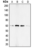 SMAD1 Antibody - Western blot analysis of SMAD1 (pS187) expression in HEK293T BMP4-treated (A); HeLa PMA-treated (B); A673 (C); PC12 (D) whole cell lysates.