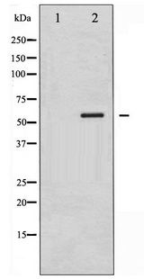 SMAD1 Antibody - Western blot of Smad1 phosphorylation expression in Mouse muscle tissue lysates,The lane on the left is treated with the antigen-specific peptide.