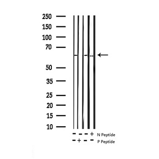 SMAD1 Antibody - Western blot analysis of Phospho-Smad1 (Ser187) expression in various lysates