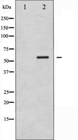 SMAD1 Antibody - Western blot analysis of Smad1 phosphorylation expression in mouse muscle tissue lysates. The lane on the left is treated with the antigen-specific peptide.