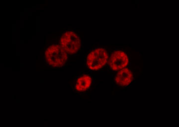 SMAD1 Antibody - Staining HeLa cells by IF/ICC. The samples were fixed with PFA and permeabilized in 0.1% Triton X-100, then blocked in 10% serum for 45 min at 25°C. The primary antibody was diluted at 1:200 and incubated with the sample for 1 hour at 37°C. An Alexa Fluor 594 conjugated goat anti-rabbit IgG (H+L) Ab, diluted at 1/600, was used as the secondary antibody.