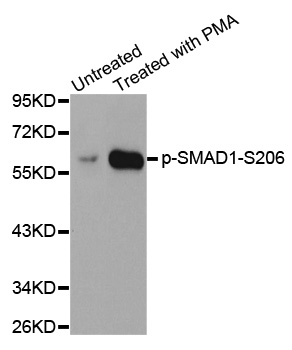 SMAD1 Antibody - Western blot analysis of extracts from Hela cells.