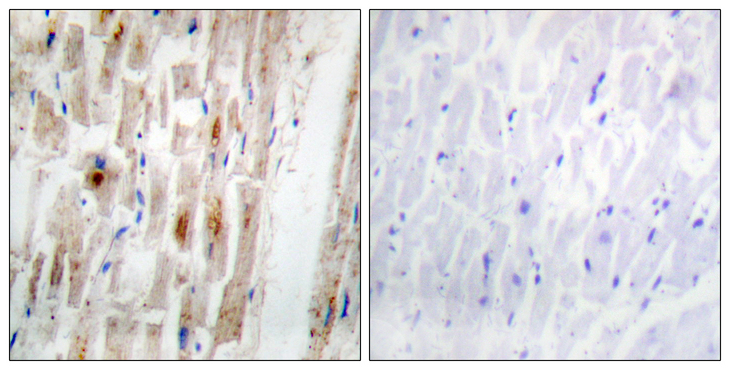 SMAD1 Antibody - Immunohistochemistry analysis of paraffin-embedded human heart, using Smad1 (Phospho-Ser465) Antibody. The picture on the right is blocked with the phospho peptide.