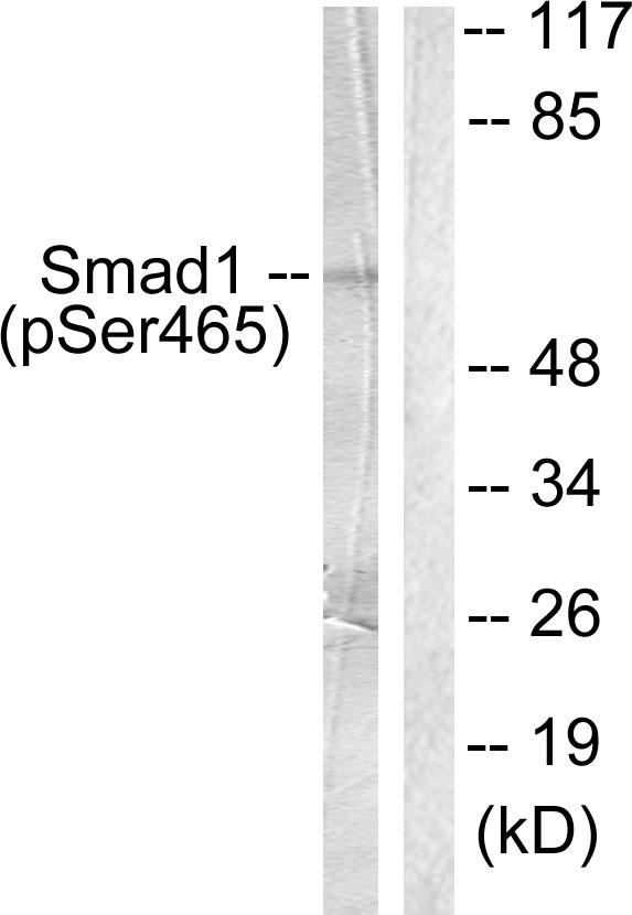 SMAD1 Antibody - Western blot analysis of lysates from HeLa cells treated with Serum 10% 15', using Smad1 (Phospho-Ser465) Antibody. The lane on the right is blocked with the phospho peptide.