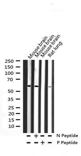 SMAD1 Antibody - Western blot analysis of Phospho-Smad1 (Ser465) expression in various lysates