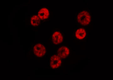 SMAD1 Antibody - Staining HeLa cells by IF/ICC. The samples were fixed with PFA and permeabilized in 0.1% Triton X-100, then blocked in 10% serum for 45 min at 25°C. The primary antibody was diluted at 1:200 and incubated with the sample for 1 hour at 37°C. An Alexa Fluor 594 conjugated goat anti-rabbit IgG (H+L) Ab, diluted at 1/600, was used as the secondary antibody.