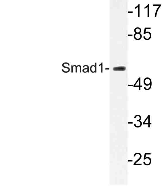 SMAD1 Antibody - Western blot of Smad1 (P457) pAb in extracts from COS7 cells.