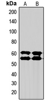 SMAD2+3 Antibody - Western blot analysis of SMAD2/3 expression in Jurkat (A); PC12 (B) whole cell lysates.