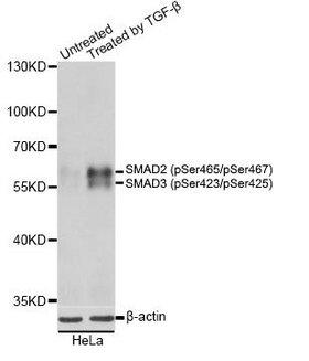 SMAD2+3 Antibody - Western blot analysis of extracts from HeLa cells untreated or treated with TGF-b using Rabbit anti SMAD2 /SMAD3 antibody at a 1/1000 dilution. Cells were cultured in serum free media overnight before treatment with TGF-b for 30 minutes. 3% BSA was used for blocking.