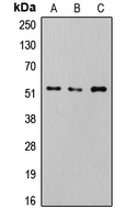 SMAD2+3 Antibody - Western blot analysis of SMAD2/3 (pT8) expression in HeLa Calyculin A-treated (A); Jurkat (B); RAW264.7 (C) whole cell lysates.