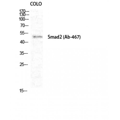 SMAD2 Antibody - Western blot of Smad2 antibody