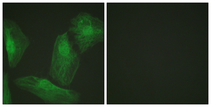SMAD2 Antibody - Immunofluorescence analysis of HeLa cells, using Smad2 Antibody. The picture on the right is blocked with the synthesized peptide.
