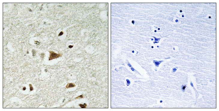 SMAD2 Antibody - Immunohistochemistry analysis of paraffin-embedded human brain tissue, using Smad2 Antibody. The picture on the right is blocked with the synthesized peptide.