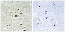 SMAD2 Antibody - Immunohistochemistry analysis of paraffin-embedded human brain tissue, using Smad2 Antibody. The picture on the right is blocked with the synthesized peptide.