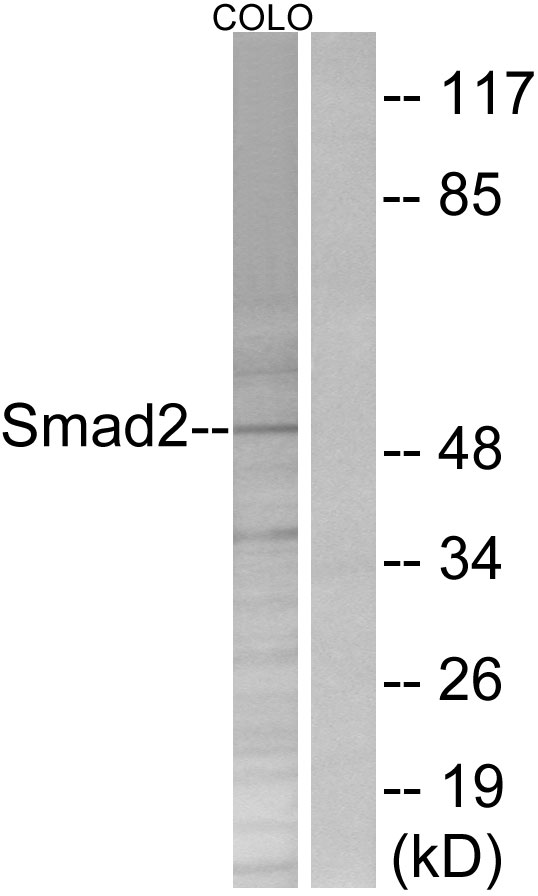 SMAD2 Antibody - Western blot analysis of lysates from COLO205 cells, treated with serum 20% 15', using Smad2 Antibody. The lane on the right is blocked with the synthesized peptide.